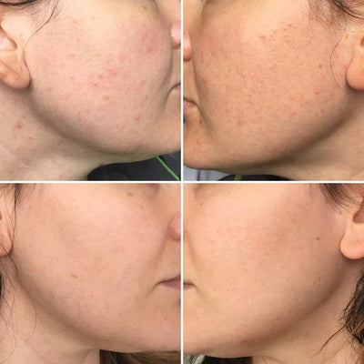 Orange Glow Enzyme Gel